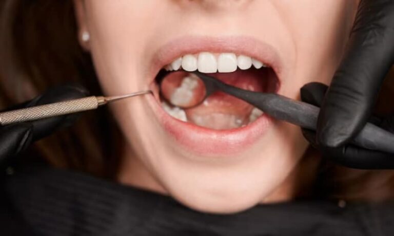 Are Dental Sealants Safe?