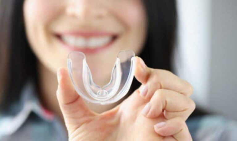 What Are Mouth Guard & How They Work