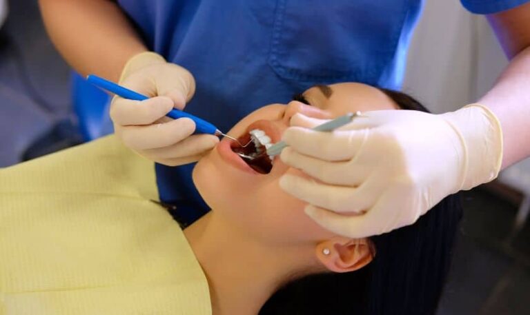 Benefits And Drawbacks Of Dental Sealants