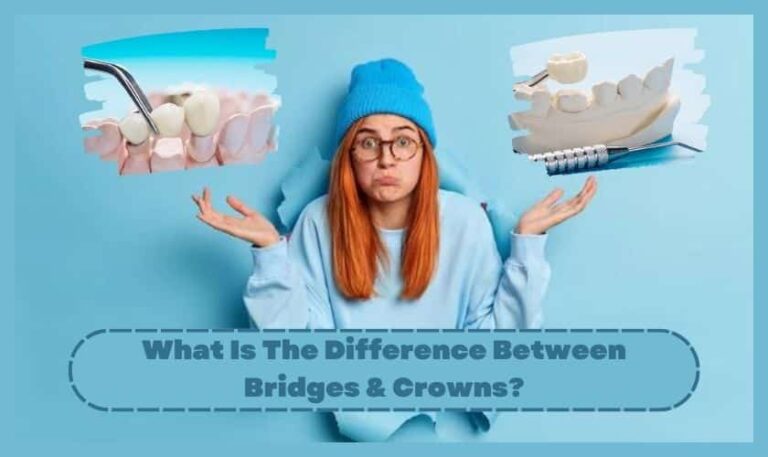 What Is The Difference Between Bridges & Crowns? 